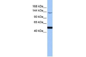 WB Suggested Anti-MAP3K1 Antibody Titration:  0. (MAP3K1 抗体  (C-Term))