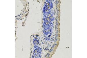 Immunohistochemistry of paraffin-embedded mouse lung using GPHN antibody. (Gephyrin 抗体  (AA 520-769))
