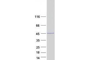 Validation with Western Blot