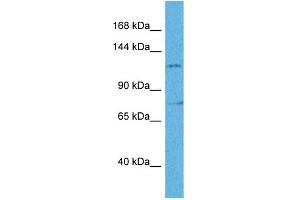 Western Blotting (WB) image for anti-Zinc Finger E-Box Binding Homeobox 2 (ZEB2) (N-Term) antibody (ABIN2778075)
