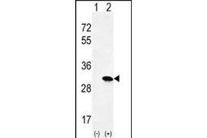 Western blot analysis of HRAS (arrow) using rabbit polyclonal HRAS Antibody (C-term) (ABIN655622 and ABIN2845102). (HRAS 抗体  (C-Term))