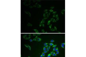 Immunofluorescence analysis of HeLa cells using AK1 Polyclonal Antibody (Adenylate Kinase 1 抗体)
