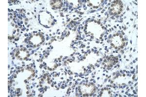 Rabbit Anti-SRBD1 antibody         Paraffin Embedded Tissue:  Human Lung    cell Cellular Data:  alveolar cell    Antibody Concentration:  4. (SRBD1 抗体  (N-Term))
