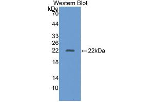 Western blot analysis of recombinant Human AAP. (ALT 抗体  (AA 581-738))