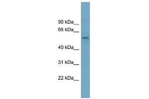 SLC22A15 antibody used at 1 ug/ml to detect target protein. (SLC22A15 抗体  (Middle Region))