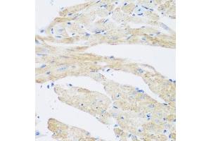 Immunohistochemistry (IHC) image for anti-N-Acetyltransferase 8B (GCN5-Related, Putative, Gene/pseudogene) (NAT8B) (AA 75-165) antibody (ABIN6144383)
