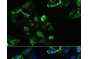 Immunofluorescence analysis of U2OS cells using CXCR5 Polyclonal Antibody at dilution of 1:100. (CXCR5 抗体)