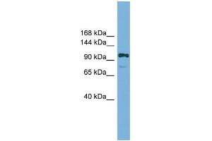 WB Suggested Anti-Hira Antibody Titration:  0. (HIRA 抗体  (Middle Region))