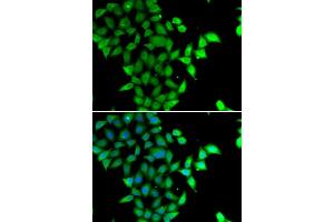 Immunofluorescence analysis of U20S cell using STAM2 antibody. (STAM2 抗体)