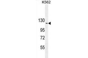 Western Blotting (WB) image for anti-rho GTPase Activating Protein 17 (ARHGAP17) antibody (ABIN2995824) (ARHGAP17 抗体)