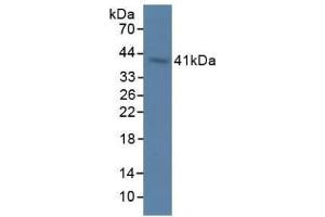 Detection of OAS1 in Rat Stomach Tissue using Polyclonal Antibody to 2',5'-Oligoadenylate Synthetase 1 (OAS1) (OAS1 抗体  (AA 139-358))