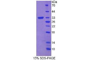 SDS-PAGE analysis of Mouse ROM1 Protein. (ROM1 蛋白)
