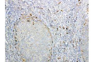 Immunohistochemistry (IHC) image for anti-Galactosamine (N-Acetyl)-6-Sulfate Sulfatase (GALNS) (AA 181-289) antibody (ABIN5693230)