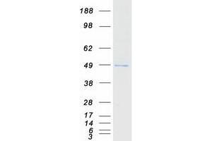 Western Blotting (WB) image for Kelch Domain Containing 2 (KLHDC2) protein (Myc-DYKDDDDK Tag) (ABIN2724302)