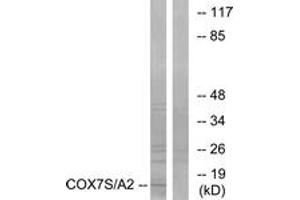 Western blot analysis of extracts from rat heart cells, using COX7S/A2 Antibody. (COX7S/A2 (AA 1-50) 抗体)