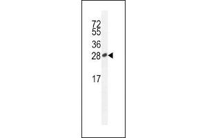 ICOS antibody western blot analysis in Jurkat lysate (ICOS 抗体  (AA 156-185))