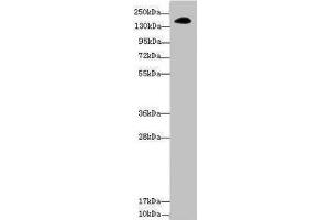 Western blot All lanes: NUP155 antibody at 3. (NUP155 抗体  (AA 1102-1391))