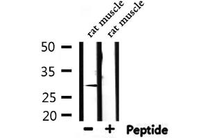 Western Blotting (WB) image for anti-Decorin (DCN) (Internal Region) antibody (ABIN6261239)