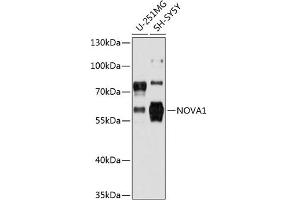 Western blot analysis of extracts of various cell lines, using NOV antibody (2030) at 1:3000 dilution. (NOVA1 抗体  (AA 408-507))