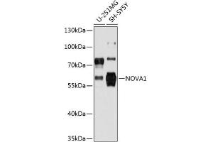 Western Blotting (WB) image for anti-Neuro-Oncological Ventral Antigen 1 (NOVA1) (AA 408-507) antibody (ABIN6144744)