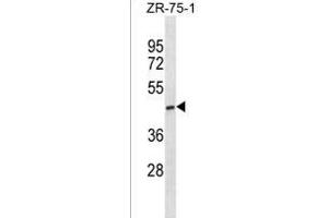 ST6GALNAC5 Antibody (C-term) (ABIN1881843 and ABIN2838433) western blot analysis in ZR-75-1 cell line lysates (35 μg/lane). (ST6GALNAC5 抗体  (C-Term))