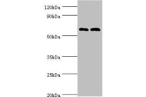 Western blot All lanes: Serine/threonine-protein kinase PAK 2 antibody at 2 μg/mL Lane 1: Jurkat whole cell lysate Lane 2: Hela whole cell lysate Secondary Goat polyclonal to rabbit IgG at 1/10000 dilution Predicted band size: 58 kDa Observed band size: 58 kDa (PAK2 抗体  (AA 1-212))