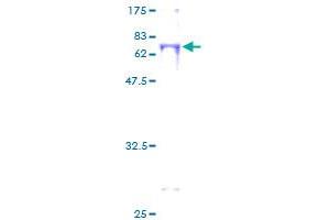 BBOX1 Protein (AA 1-387) (GST tag)