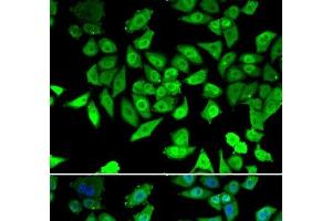 Immunofluorescence analysis of U2OS cells using CCAR2 Polyclonal Antibody (CCAR2 抗体)