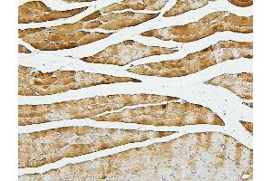 IHC analysis of Cofilin-2 using anti-Cofilin-2 antibody (ABIN7602747).