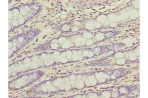 Immunohistochemistry of paraffin-embedded human colon tissue using ABIN7165470 at dilution of 1:100 (FAM222B 抗体  (AA 351-562))