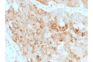 Formalin-fixed, paraffin-embedded human Kidney stained with ROR2 Mouse Monoclonal Antibody (ROR2/1911). (ROR2 抗体)
