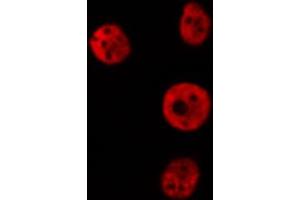 ABIN6274172 staining Hela cells by IF/ICC. (IRF2 抗体  (Internal Region))