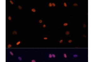 Immunofluorescence analysis of C6 cells using TriMethyl-Histone H3-K27 Polyclonal Antibody at dilution of 1:100.