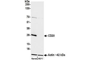 Western Blotting (WB) image for anti-Membrane-Spanning 4-Domains, Subfamily A, Member 1 (MS4A1) antibody (ABIN7449560)