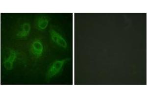 Immunofluorescence analysis of HeLa cells, using MAP4 (Ab-696) Antibody. (MAP4 抗体  (AA 662-711))
