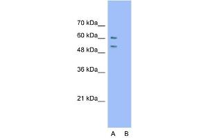Host:  Rabbit  Target Name:  ARIH2  Sample Type:  Jurkat  Lane A:  Primary Antibody  Lane B:  Primary Antibody + Blocking Peptide  Primary Antibody Concentration:  1. (ARIH2 抗体  (N-Term))