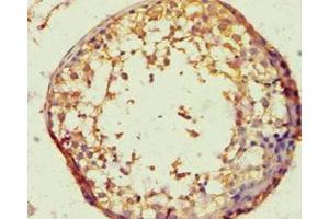 Immunohistochemistry (IHC) image for anti-BTB and CNC Homology 1, Basic Leucine Zipper Transcription Factor 1 (BACH1) (AA 1-320) antibody (ABIN7172716)