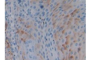 Immunohistochemistry (IHC) image for anti-Protein tyrosine Phosphatase, Receptor Type, H (PTPRH) (AA 844-1096) antibody (ABIN7442888)
