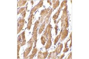 Immunohistochemistry of CRTH2 in human heart tissue with CRTH2 antibody at 2. (Prostaglandin D2 Receptor 2 (PTGDR2) (N-Term) 抗体)