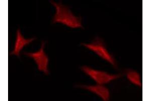 ABIN6267438 staining NIH-3T3 by IF/ICC. (RPS6KB1 抗体  (pSer371))