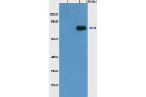 L1 mouse embryo lysates L2 mouse thymus lysates probed with Anti Phospho-Syk (Tyr525/526) Polyclonal Antibody, Unconjugated (ABIN746273) at 1:200 overnight at 4 °C. (SYK 抗体  (pTyr525, pTyr526))