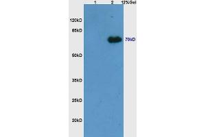 L1 mouse embryo lysates L2 mouse thymus lysates probed with Anti Phospho-Syk (Tyr525/526) Polyclonal Antibody, Unconjugated (ABIN746273) at 1:200 overnight at 4 °C.