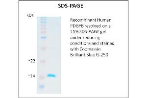 SDS-PAGE (SDS) image for Platelet Derived Growth Factor Subunit B (PDGFB) (Active) protein (ABIN5509325) (PDGFB 蛋白)