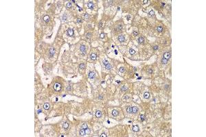 Immunohistochemistry of paraffin-embedded human liver injury using HIP1 antibody at dilution of 1:100 (x40 lens). (HIP1 抗体)