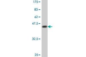 Western Blotting (WB) image for anti-SRY (Sex Determining Region Y)-Box 9 (SOX9) (AA 400-509) antibody (ABIN562959)