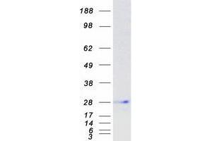 Western Blotting (WB) image for Immunoglobulin J Polypeptide, Linker Protein For Immunoglobulin alpha and mu Polypeptides (IGJ) protein (Myc-DYKDDDDK Tag) (ABIN2723431)