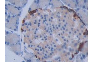 DAB staining on IHC-P; Samples: Rat Pancreas Tissue (METTL21C 抗体  (AA 1-248))