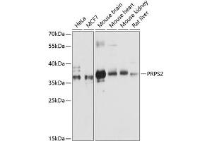 Western blot analysis of extracts of various cell lines, using PRPS2 antibody (ABIN6132521, ABIN6146272, ABIN6146274 and ABIN6216352) at 1:3000 dilution. (PRPS2 抗体  (AA 1-240))