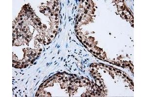 Immunohistochemical staining of paraffin-embedded liver tissue using anti-LTA4H mouse monoclonal antibody. (LTA4H 抗体)