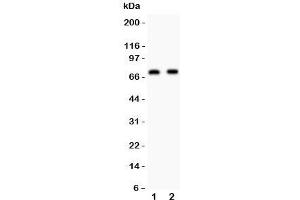 Western blot testing of Numb antibody and Lane 1: human U87;  2: mouse Neuro-2a lysate. (NUMB 抗体  (AA 194-220))